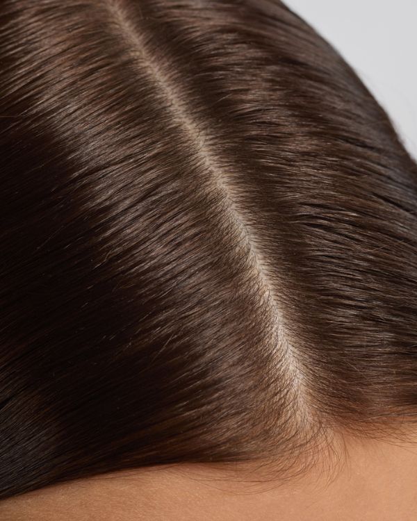 How a balanced scalp beats dandruff naturally